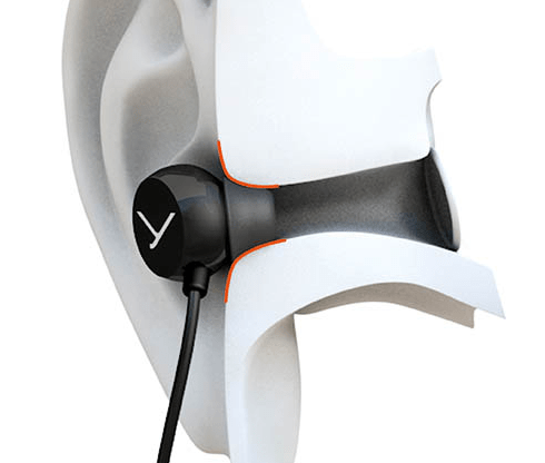 In-Ear-Passform