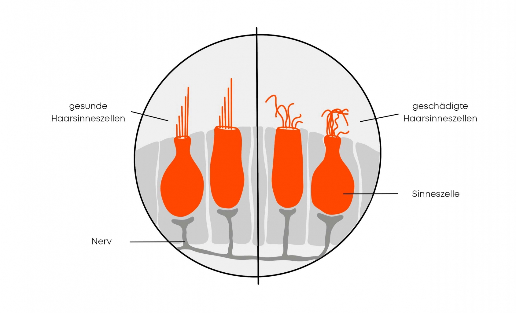 Gesunde und geschädigte Haarsinneszellen